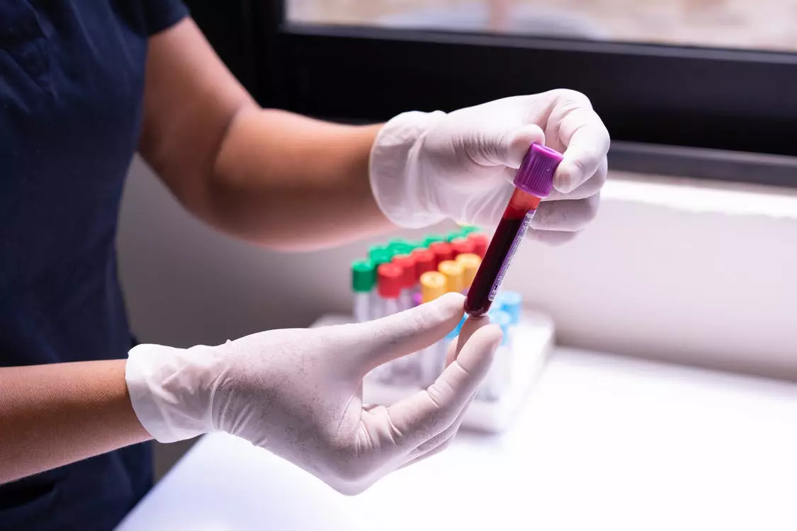 Hematološka biološka laboratorija (11).jpeg